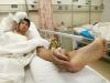 أطباء صينيون يزرعون يد مريض في قدمه