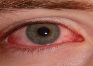 التحديق مطولا في شاشات الكمبيوتر يجهد العينين ولا يسبب العمى