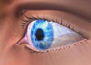 جفاف العين: أسبابه وطرق علاجه