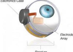 عين اصطناعية تمنح كفيفي البصر أملا جديدا 